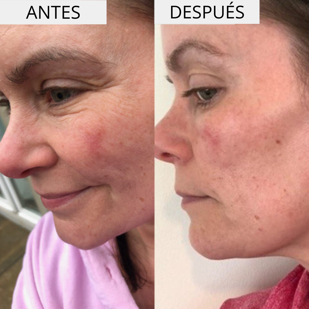 HYDRA +  CREMA HIDRATANTE
