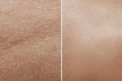 HYDRA +  CREMA HIDRATANTE